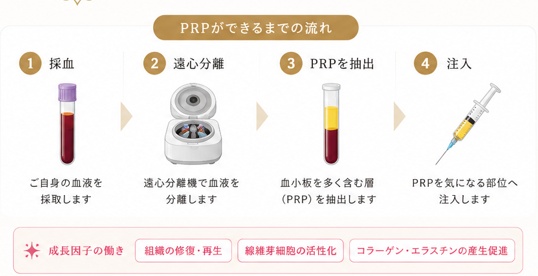 PRPができるまでの流れ — ①採血（ご自身の血液を採取）②遠心分離（血液を分離）③PRPを抽出（血小板を多く含む層）④注入（気になる部位へ）。成長因子の働き：組織の修復・再生／線維芽細胞の活性化／コラーゲン・エラスチンの産生促進。