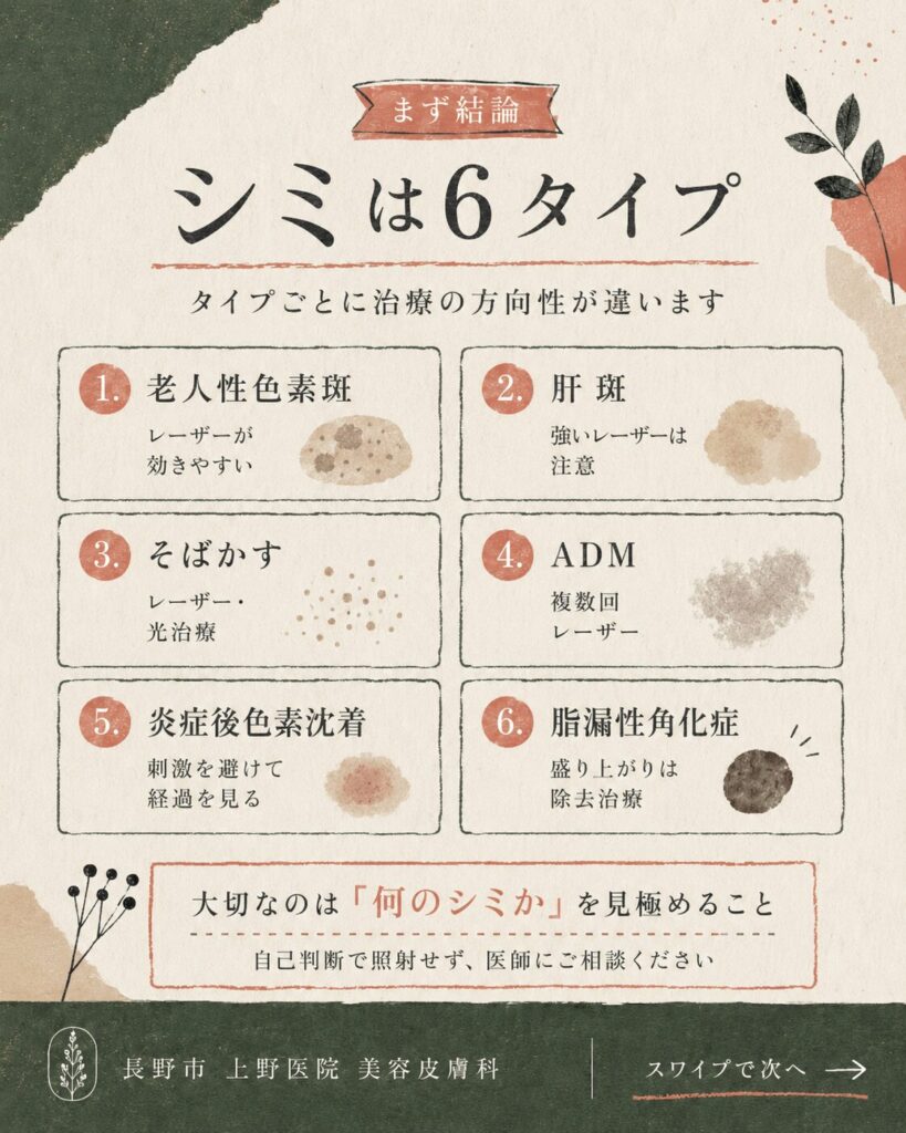 シミの種類と見分け方｜6タイプを医師が解説【長野市 上野医院】