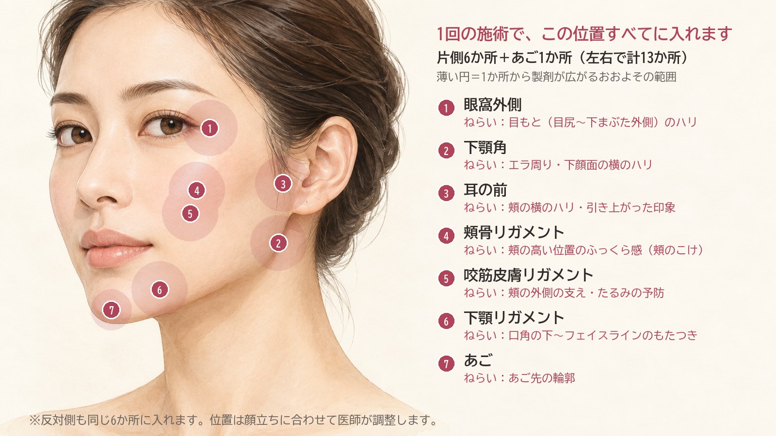 ジャルプロを入れる位置(片側6か所とあご1か所、左右で計13か所)と各位置のねらい